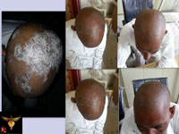 Before and after treatments