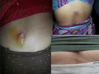 Before and after treatments